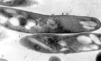 Image: Transmission electron micrograph (TEM) of Mycobacterium tuberculosis (Photo courtesy of Dr. Elizabeth White).